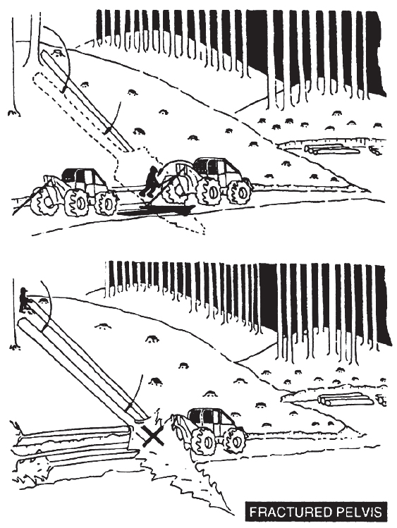 [image] Shows direction of falling tree and skidder operator pinned beneath it